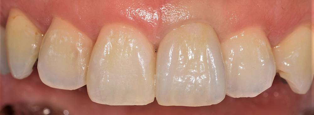CDS