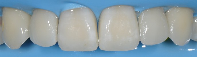 CDS